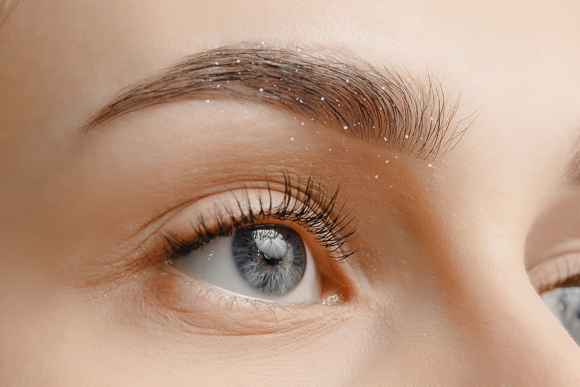 Pourquoi j'ai des pellicules dans les sourcils ?