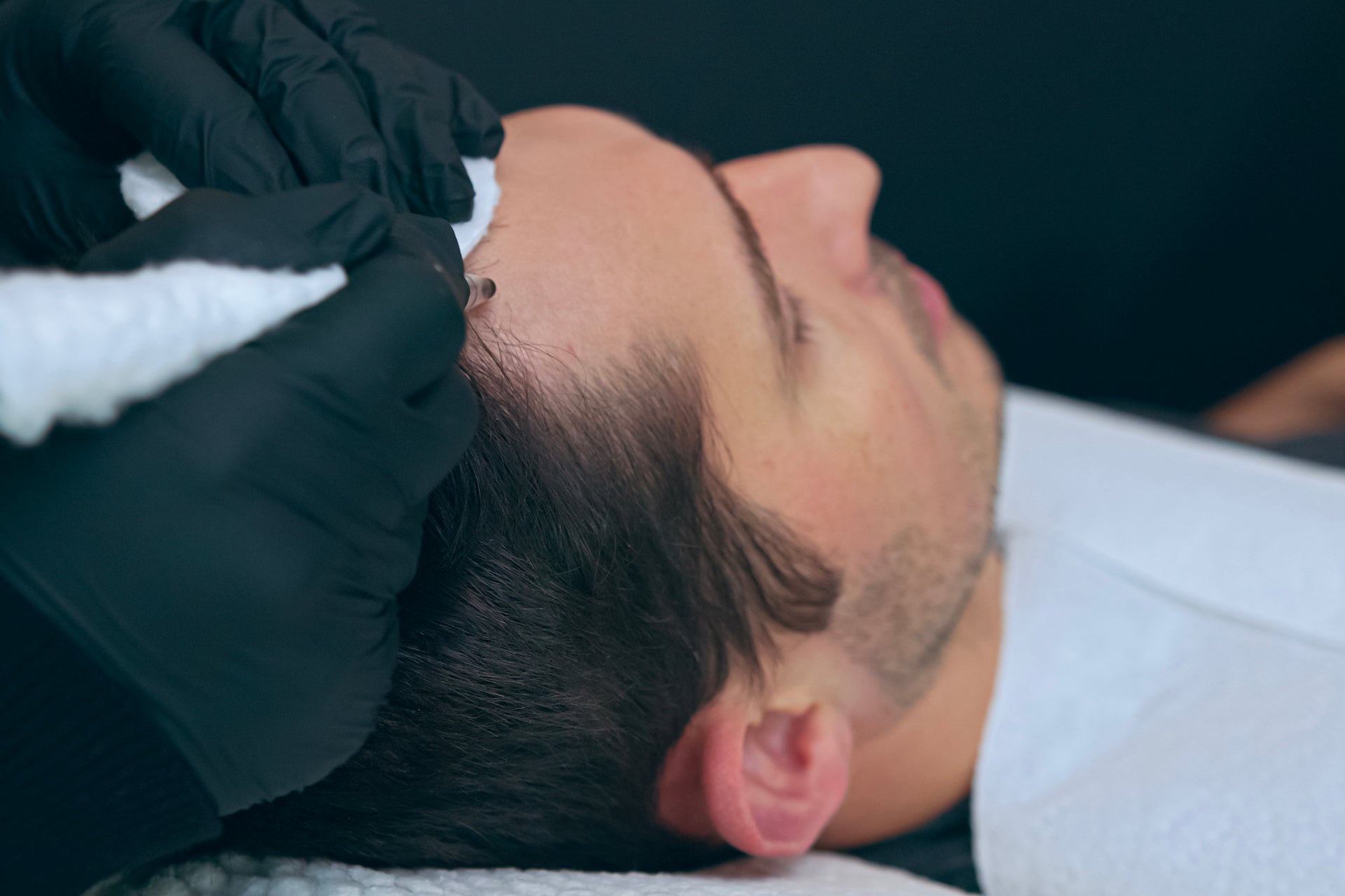 Qu'est-ce que la tricopigmentation ?