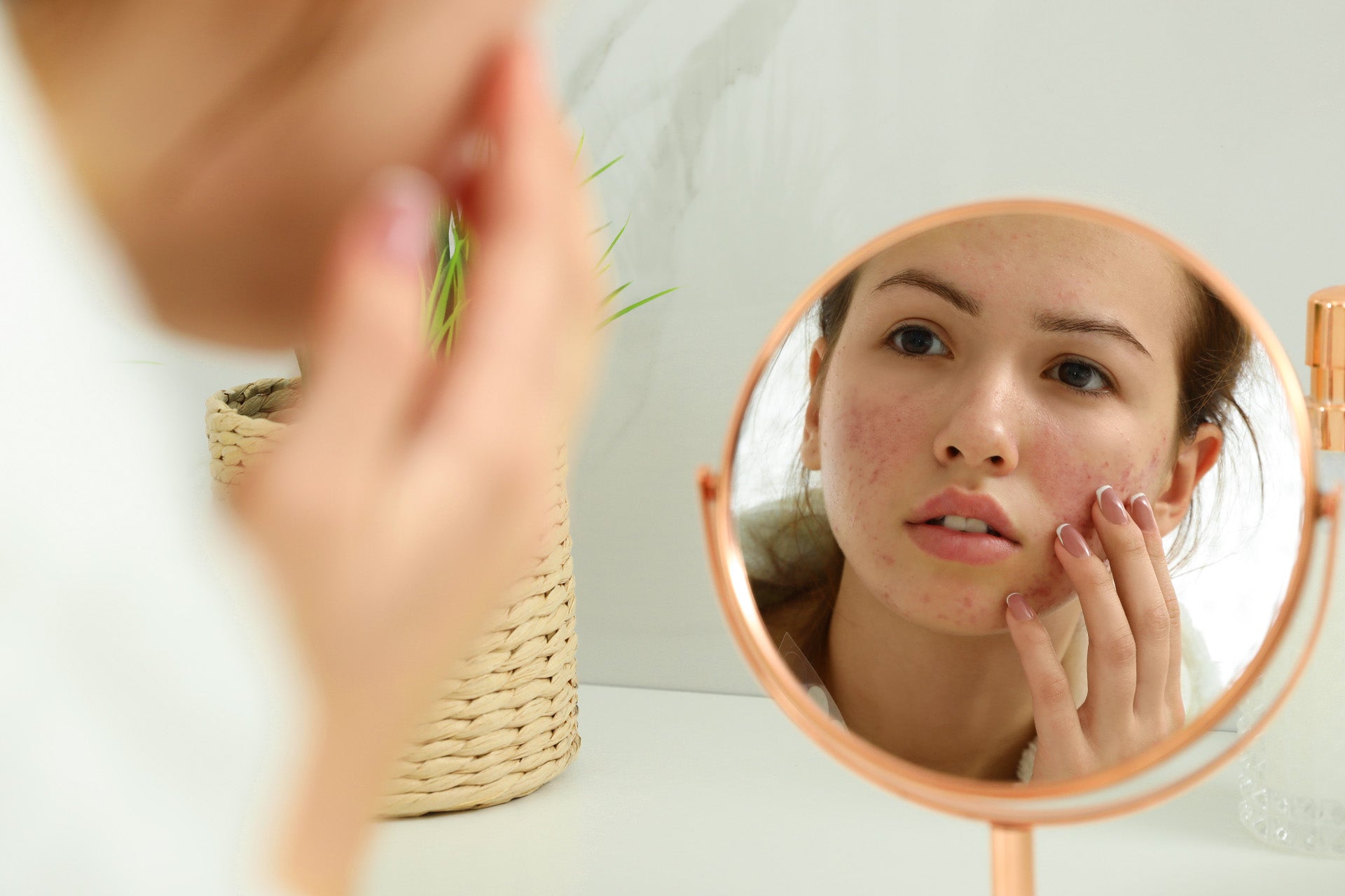 Comment se maquiller quand on a une peau acnéique ?