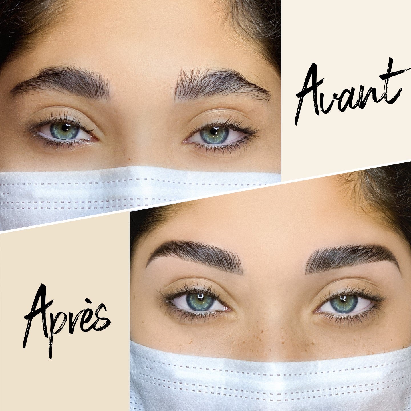 Brow lift, ce qu’il faut savoir sur la tendance qui fait du bruit